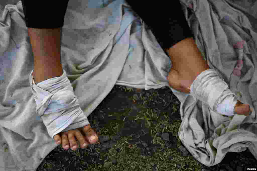 A migrant woman who is seeking to reach the U.S. border rests with her bandaged feet outside the "Decanal Guadalupano" migrant shelter in Tierra Blanca, Mexico, before continuing her journey through Mexico, Jan. 24, 2024.