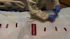 COVID-19, Overdoses Pushed US to Highest Death Total Ever 
