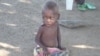 Criança subnutrida em Namibe