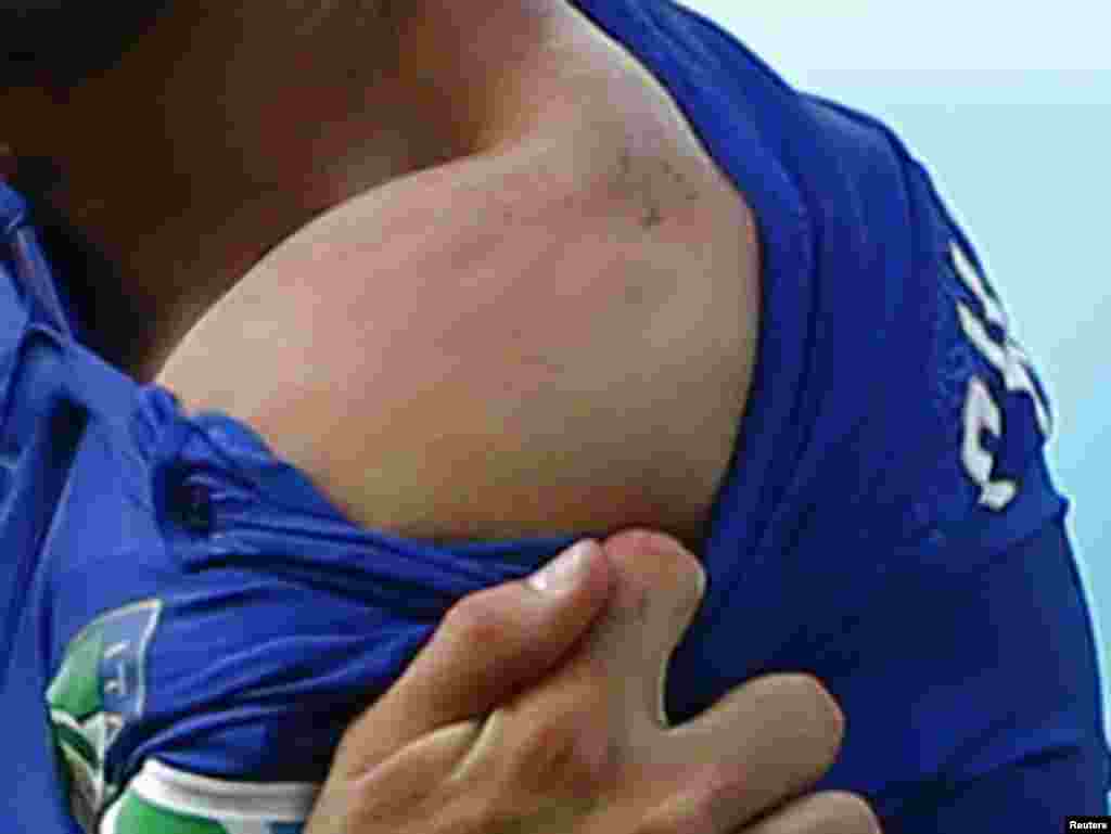 O ombro de Giorgio Chiellini depois da dentada de Luis Suarez, durante o jogo entre a Itália e o Uruguai, Arena das Dunas, Natal, Junho 24, 2014.