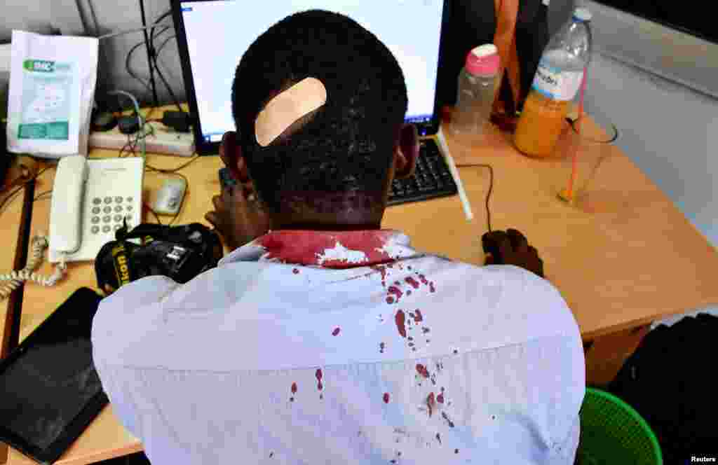 Paul Murungi, a journalist working with The New Vision newspaper is seen at his desk after he was injured following an attack by security officials, outside the United Nations Human Rights offices while on reporting duty, in Kampala, Uganda.