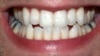 Man shows his teeth