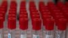WHO Aiming for 2 Billion Doses of COVID Vaccine by End of 2021