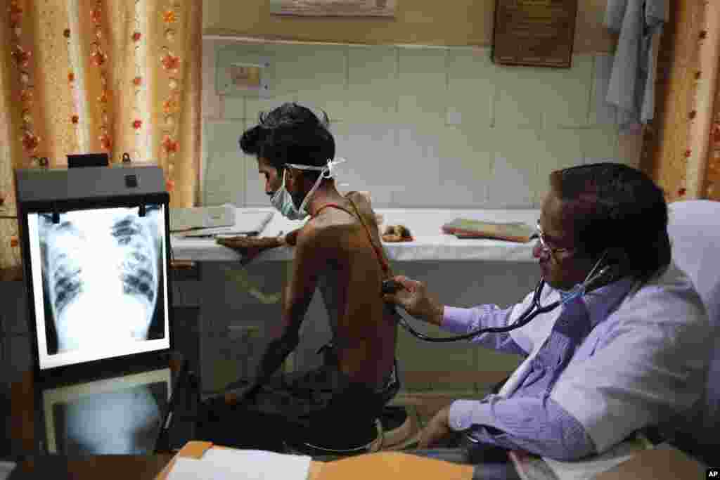 An Indian doctor examines a tuberculosis patient in a government TB hospital on World Tuberculosis Day in Allahabad, India. India has the highest incidence of TB in the world, according to the World Health Organization's Global Tuberculosis Report 2013.