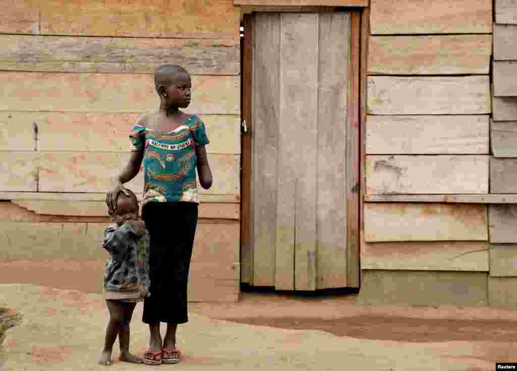 Mave Grace, 11, who had part of her arm chopped off by militiamen when they attacked the village of Tchee, stands with her sister Racahele-Ngabausi, 2, in an Internally Displaced Camp in Bunia, Ituri province, eastern Democratic Republic of Congo, April 14, 2018.