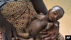 Mtoto mwenye utapiamlo akiwa ameshikiliwa na mama yake